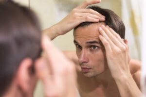 Hair fall in men
